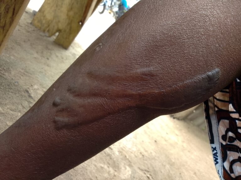 Quand le bois de chauffe devient un danger